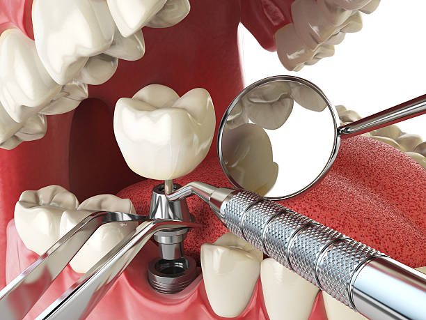 Best Weekend Emergency Dentist in Perry, LA